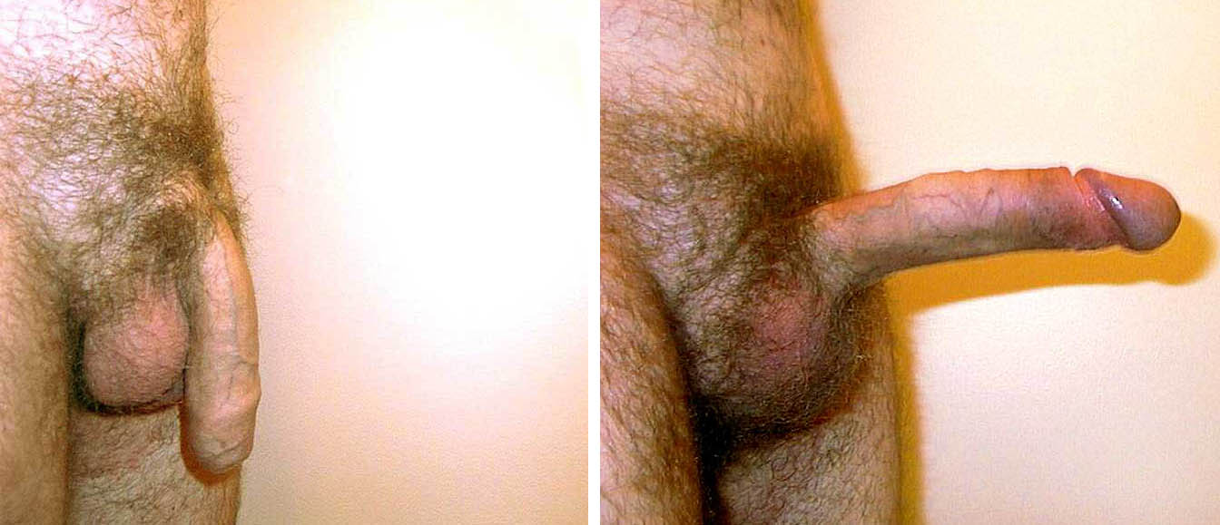 Hairest penis 💖 Position of penis - Admos.eu